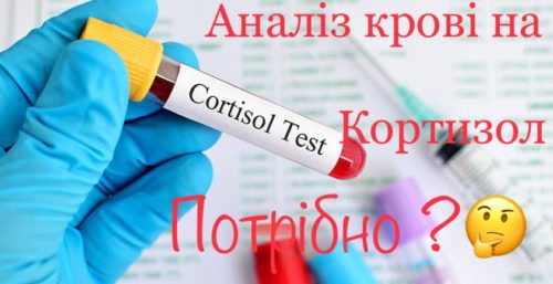 Аналіз крові на кортизол – коли потрібно здавати, а коли ні і чому інколи це марно витрачені кошти розповідає лікар-невролог Євген Скрипник
